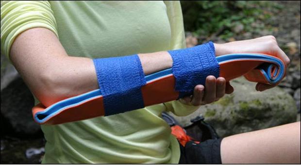 Mouldable Splint (Various sizes avaiable) – Oceania Medical New Zealand